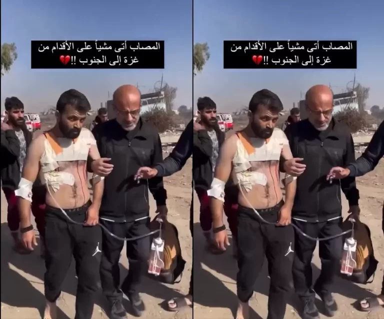 مشاهد مأساوية لجريح أجبره الاحتلال على النزوح من شمال غزة لجنوبها سيرا على الأقدام جريح أجبره الاحتلال على النزوح من شمال غزة لجنوبها سيرا على الأقدام