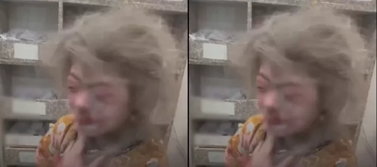 فيديو مأساوي لطفلة من ذوي الاحتياجات الخاصة مصابة في قصف إسرائيلي على غزة طفلة من ذوي الاحتياجات الخاصة مصابة في قصف إسرائيلي على غزة