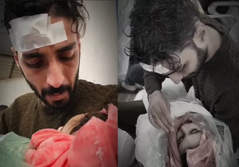 مشهد مؤثر لوداع شاب فلسطيني مصاب لابن شقيقته الشهيد بقصف الاحتلال على غزة (فيديو) وداع شاب فلسطيني مصاب لابن شقيقه الشهيد بغزة