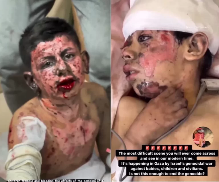 استخدام إسرائيل للفسفور الأبيض في غزة