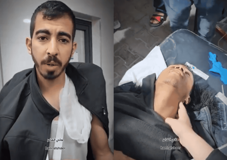 لحظة إصابة صالح الجعفراوي جراء قصف استهدفه مع أطباء مستشفى ناصر أثناء نزوحهم (فيديو) لحظة إصابة صالح الجعفراوي جراء قصف استهدفه مع أطباء مستشفى ناصر أثناء نزوحهم