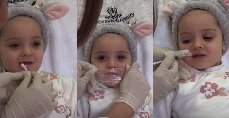 حقيقة فيديو تكبير شفاه طفلة في عيادة تجميل