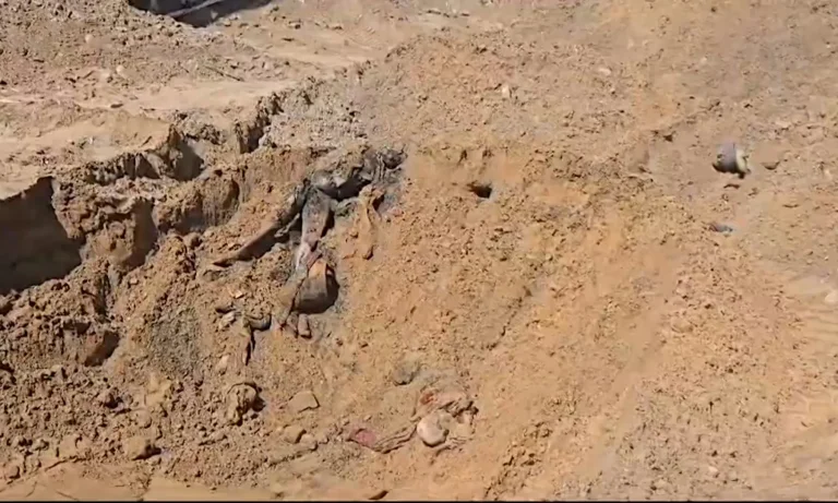 مقبرة جماعية في مستشفى الشفاء