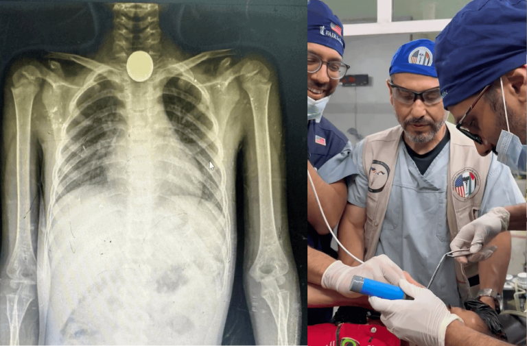 أطفال غزة يأكلون العملات والحصى من الجوع.. صور مفزعة نشرها طبيب عماني أطفال غزة يأكلون العملات والحصى من الجوع.. صور مفزعة نشرها طبيب عماني